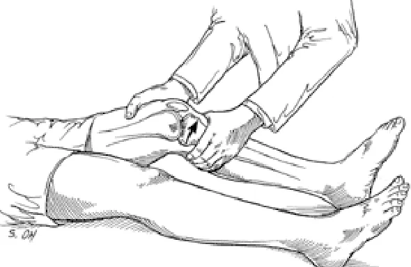 Figure 4: Lachmans test 