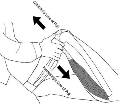 Figure 5: Anterior drawer test 