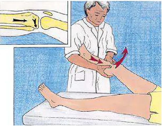 Figure 6: Pivot shift test 