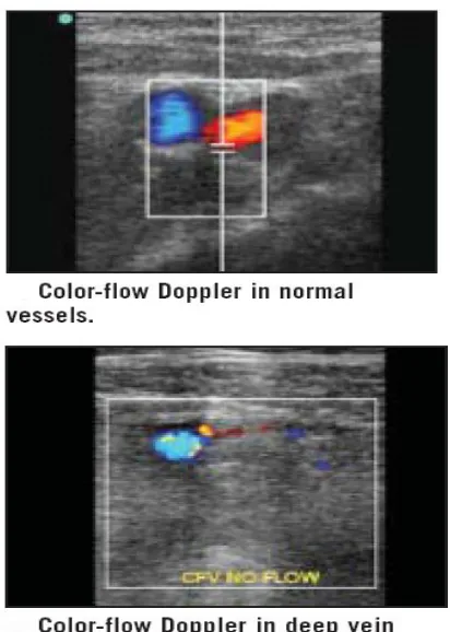 Fig.12 