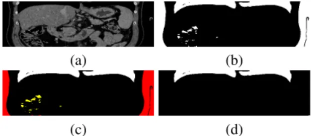 Fig. 5. Illustration of the lung segmentation on a sample coronal slice: