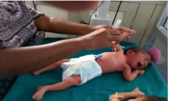 FIGURE: 9. CLEANSING PROCEDURE 