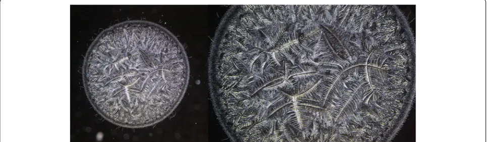 Fig. 1 Image capture of entire tear microdesiccates by using low power objective lens