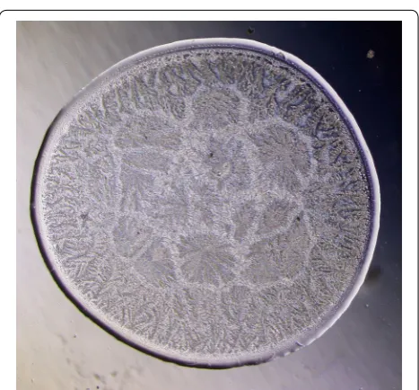 Fig. 9 Representative image of a normal tear microdesiccate as tion. Both tear microdesiccate production and the lens system of the microscope were those described in the legend to Fig