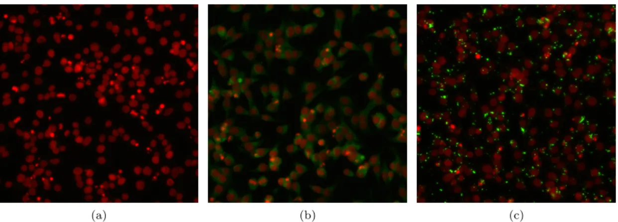 Figure 1.3: Three samples from the high throughput imaging dataset. a) no IDOL inhibition, hence no LDLR-GFP is present, only the cellular nuclei, stained red with Hoechst stain, are visible