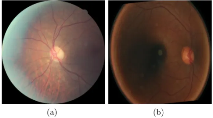 Fig. 1. Example of un-gradable images that hamper reliable analytics.