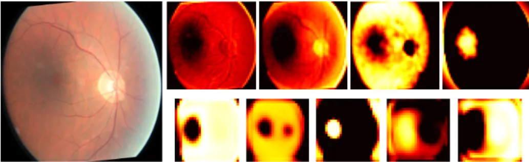 Fig. 3. Features extracted at two levels of the shallow network together with the orig- orig-inal input image (left)