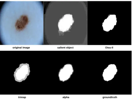 Fig 1. Proposed skin lesion segmentation approach.