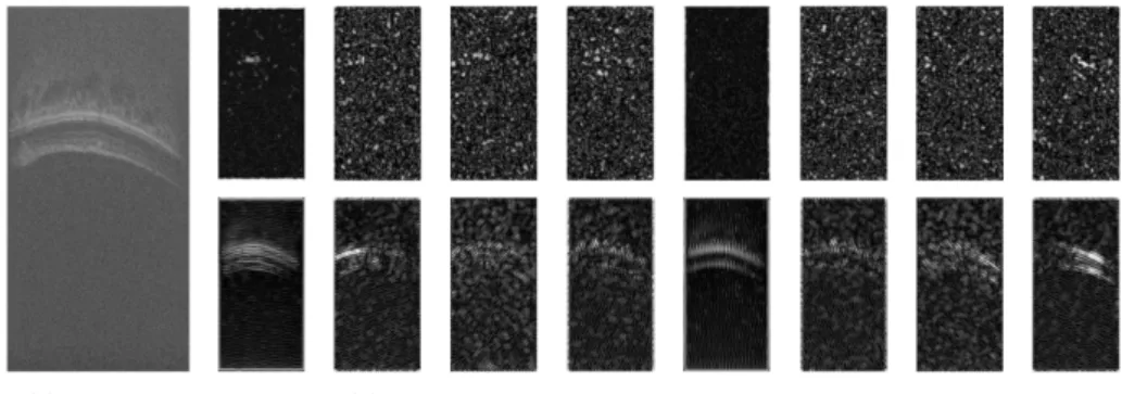 Fig. 3. (a) shows the original OCT image; (b) shows the energy feature images obtained by filtering the original image with di↵erent scales and orientations of Gabor filters.