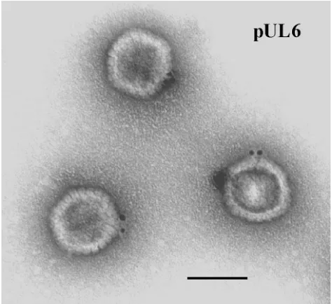 FIG. 1. Electron micrograph of HSV-1 B capsids after staining withantibody speciﬁc for pUL6 followed by an anti-antibody conjugated to