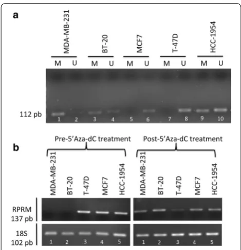 Fig. 2 mRNA expression and promoter methylation of RPRM in breast cancer cell lines. a Aberrant methylation was found in 3/5 of breast cancer cell lines studied