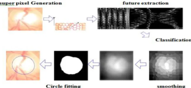 Figure 4. Morphological operations  (1) Double Ring Filter