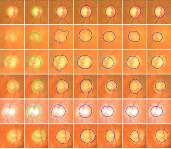 Figure 2.26 Sample results of the optic disc. From left to right columns: (a) the original images, (b) the manual 