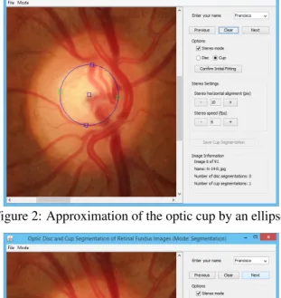 Figure 2: Approximation of the optic cup by an ellipse.