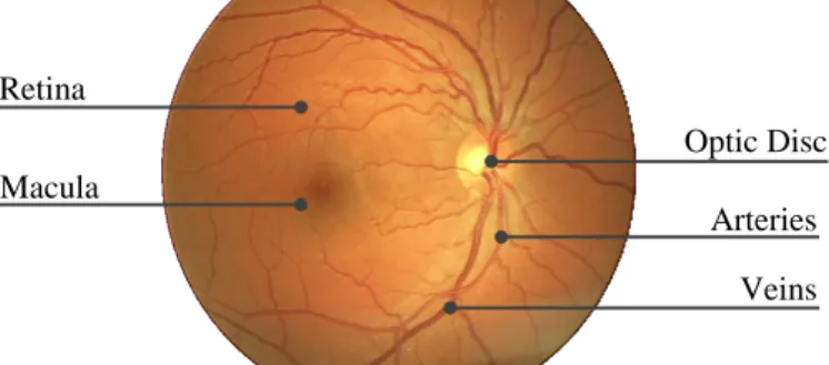 Figure 1. Eye fundus image Retina 