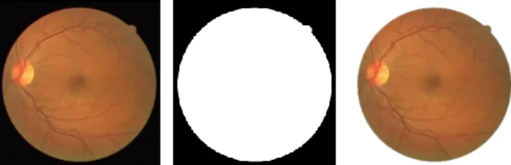 Figure 3. Mask generation 