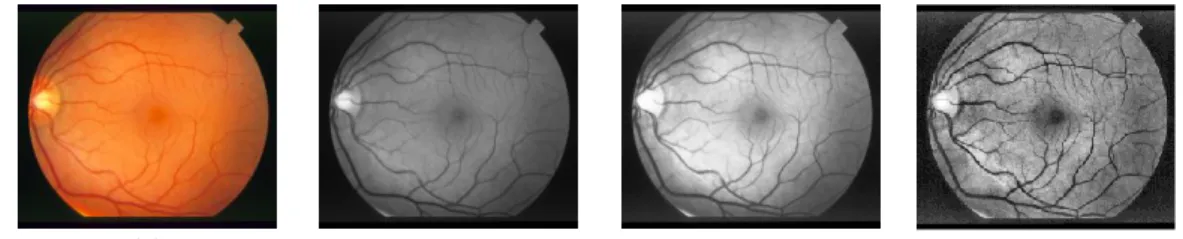 Figure 7 distinguishes the contrast of the green-band of an image using histogram equalization and CLAHE