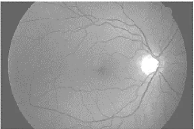 Fig. 5. Green channel extraction 