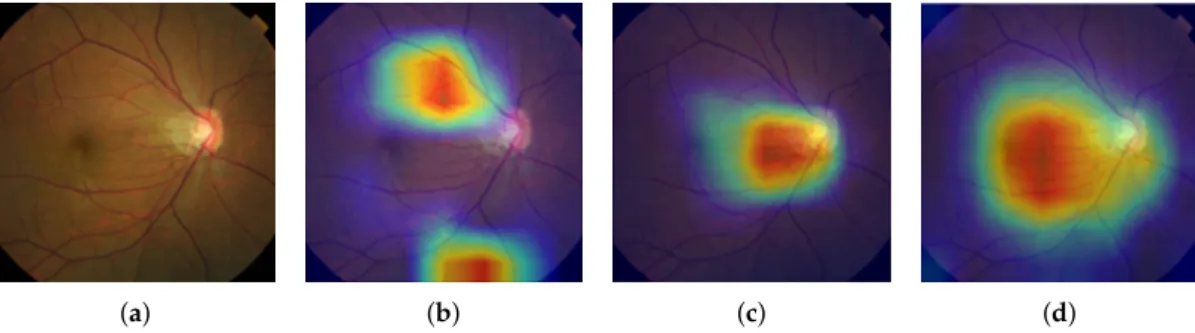 Figure 4 shows the localization results obtained by the *-M models for a fundus image taken from Dataset-C that was diagnosed as glaucomatous