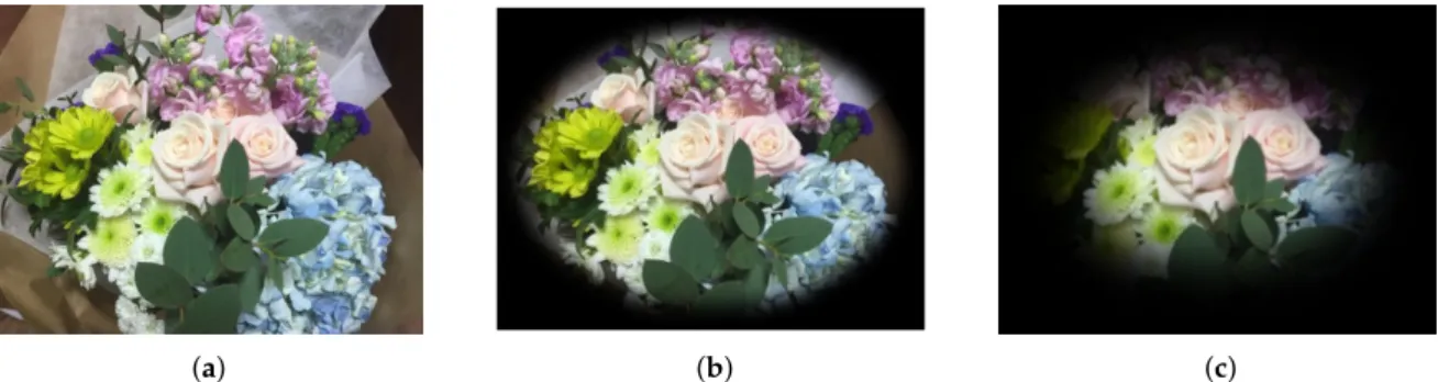 Figure 1. Progressive visual loss caused by glaucoma. (a) Normal vision. (b) As glaucoma advances, the field of vision of a patient slowly narrows