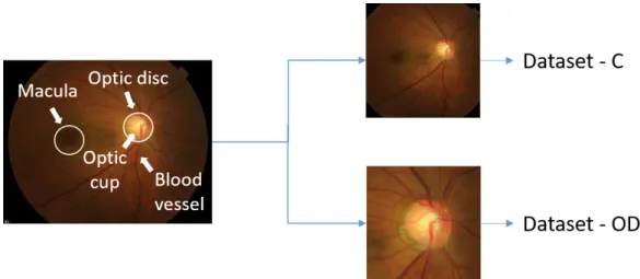 Figure 2. Taking into account the clinical importance of the Optic Disc (OD) and the macula, the original dataset was used to created two additional datasets, either by center-cropping the original images (Dataset-C) or by extracting the optic disc from th
