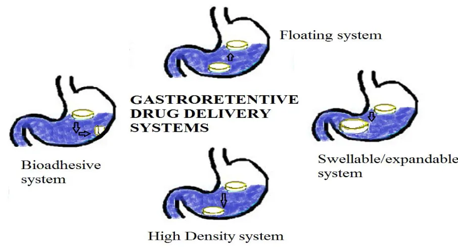 Fig.1.3: showing various approaches for gastro retentive drug delivery systems 