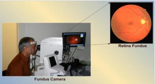 Figure 2.3 Retinal fundus camera. 
