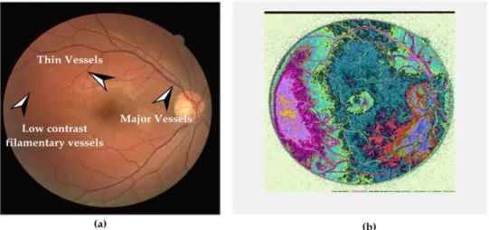 Figure 2.11 First challenge of retinal image segmentation. (a) Description of what is contained in the first  panel