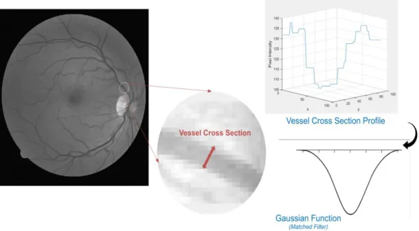 Figure 2.17 Cross-section intensity profile of the region marked by a straight line between point A and point  B on retina image