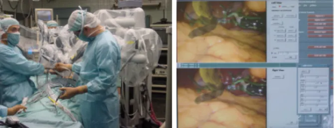 Fig.  3.  Result  images  showing  3D  organ  models  superimposed  to  the  laparoscopic  image;  a: