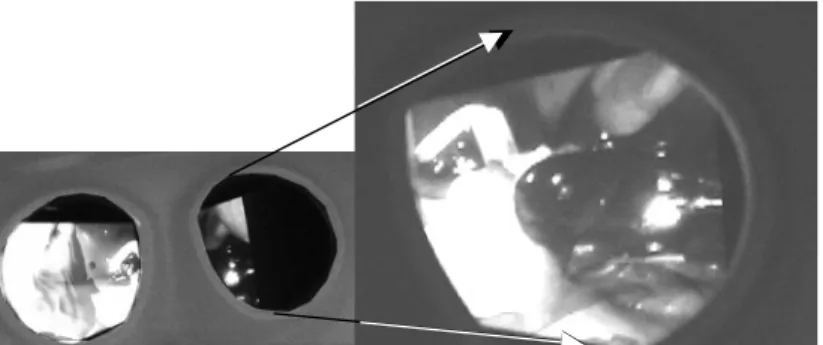 Fig.  5.  Superimposed  image  on  the  surgeon’s  console.  a:  a  scene  of  the  stereo  viewer  from surgeon’s console, b: a scene from the right eye’s viewer.