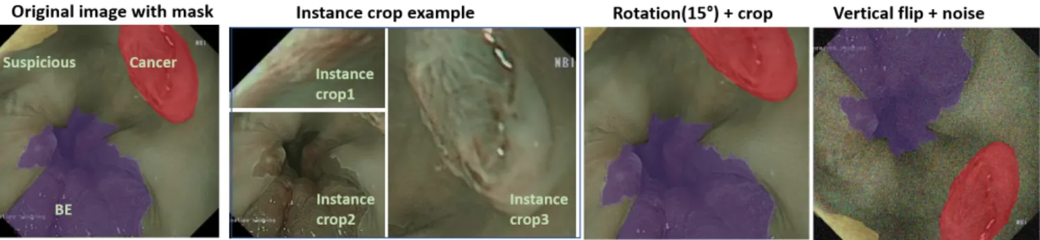Fig. 1. Augmentation methods applied on the images including transformation such as rotation, flip and instance cropping.
