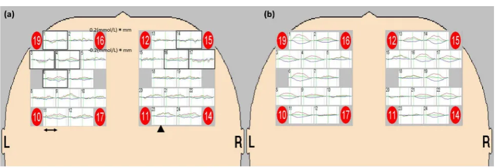 Figure 3. The change in the concentration of oxy-Hb in Task 2. (a) = ASD group (n = 20); (b)=control group (n = 45)