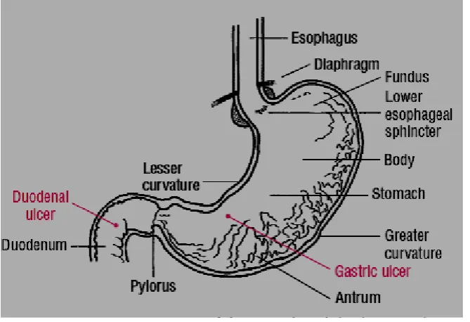 Figure 1. Structure of the stomach and duodenum ulcers 