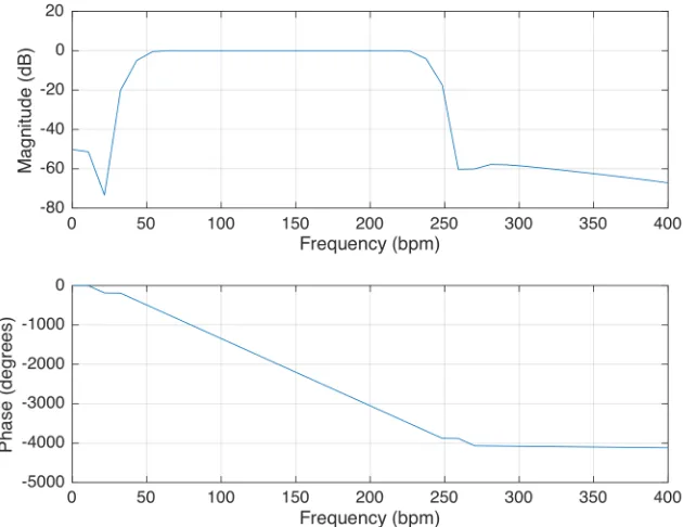 Fig. 5 – Frequency response of bandpass filter. 