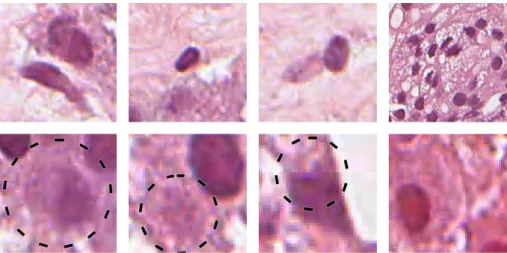 Figure 2.2: The various issues with the ground truth segmentation. The top row shows the different nuclei types and lumen aspect: the leftmost image shows a stromatic nuclei below an epithelial nuclei; the second image shows a lymphocyte; the third image s