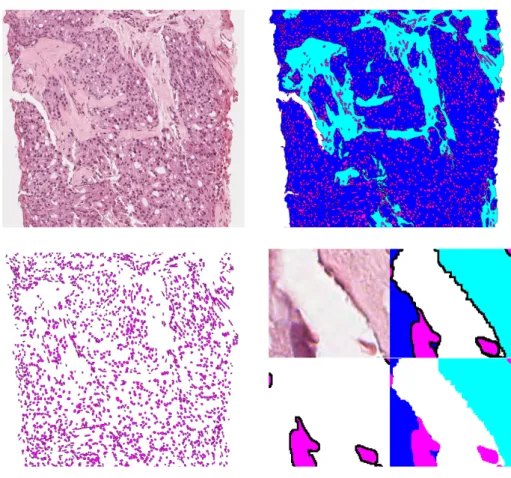 Figure 2.3: The ground truth used throughout the thesis. Top left is the original image; top right is the ground truth with all final classes; bottom left is ground truth with just nuclei; and bottom right is a zoomed-in section of the respective images in