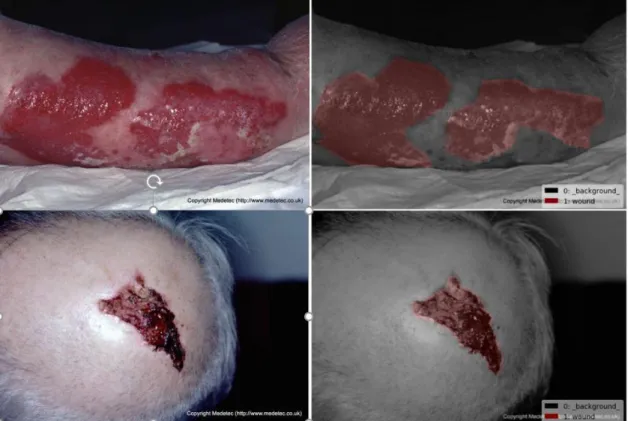 Figure 6 Labeled Wound Image 1,2 the left image is original image, the right image is labeled image 