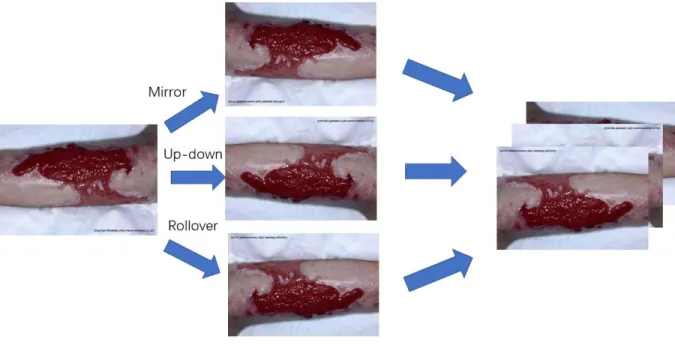 Figure 8 Image Augmentation 