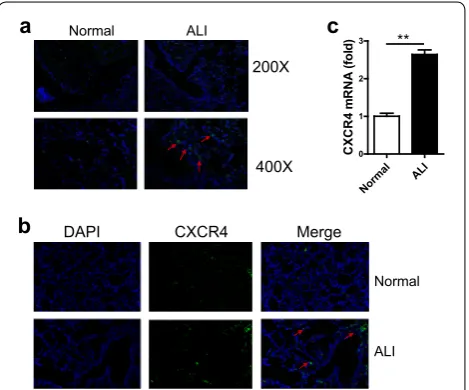 Fig. 1 The expression of CXCR4 was detected in ALI lung tissue and alveolar macrophages