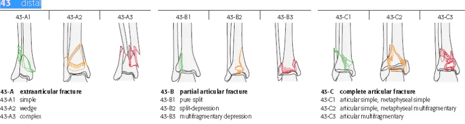 Figure 4: AO/OTA Classification of Distal Tibia Fractures 