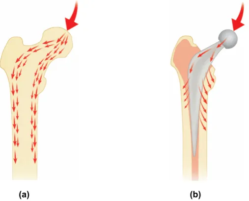 Figure 2.7: Load transfer patterns (a) Within the natural femur (b) Around the C stem 