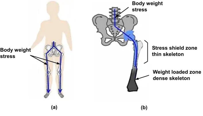 Figure 2.12: Effect of stress shielding 