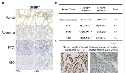 Fig. 1 IGFBP7 is downregulated in human thyroid cancer samples. a Representative images of IGFBP7 immunostaining in normal thyroid tissue, thyroid adenoma and thyroid carcinoma specimens with different pathological characteristics