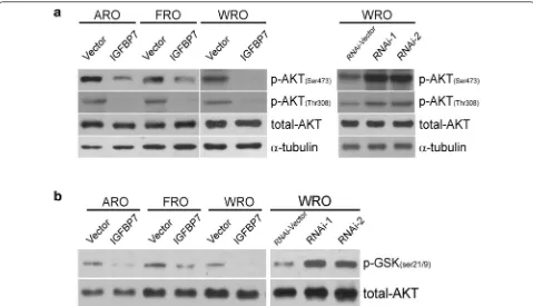 Fig. 5 IGFBP7 inhibits the phosphorylation and kinase activity of AKT. a Western blotting analysis of phosphorylated AKT (Ser 473 and Thr 308) and total AKT in the indicated cells