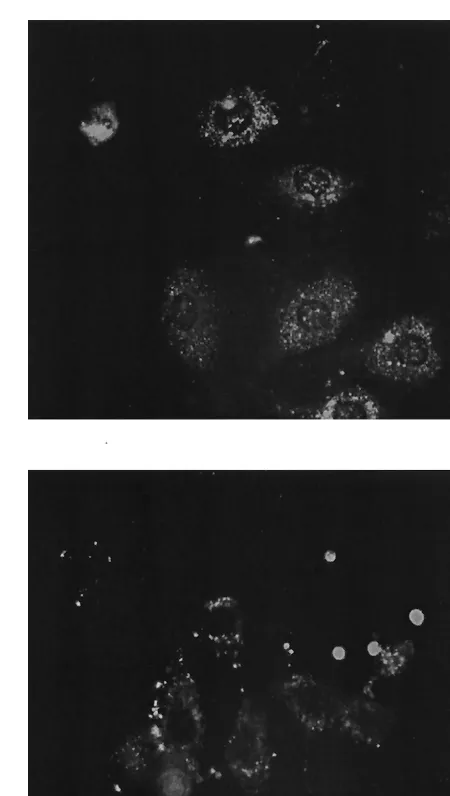FIG. 3. Photographs of untransfected ﬁxed 293T cells labeled withan anti-p27 MAb (PF12J-10A) (top), and untransfected live 293T cells