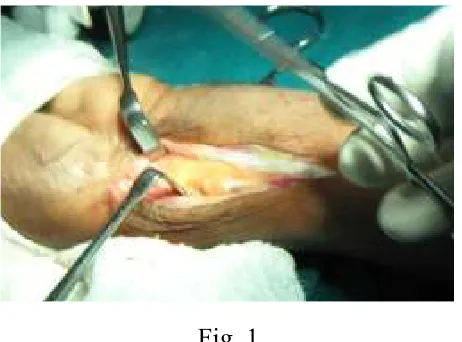 Fig. 2 79 