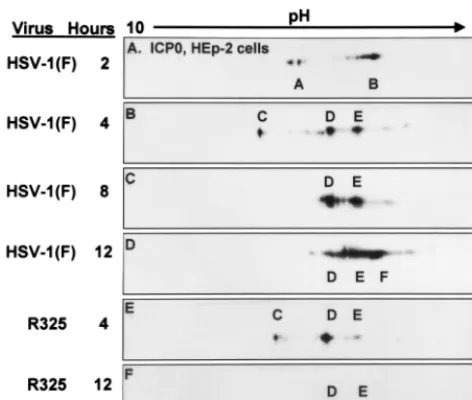 Figure 3 shows the pattern of ICP4 forms that accumulate