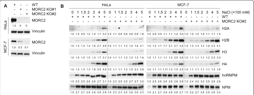 Fig. 1 MORC2 attenuates histone and DNA interaction.cells and subjected to salt solubilization assays