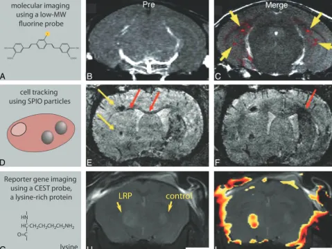 Fig 3. In vivo examples of MI studies of the brain by using MR imaging.signal-intensity-difference map superimposed on the anatomic image, indicating the LRP-expressing tumorxenograft.of a mouse brain was injected with glioma cells expressing LRP (a CEST a